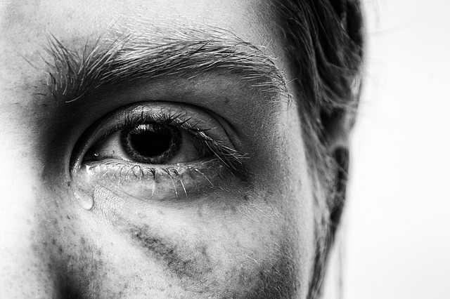 A close up of a woman's eye, with a tear trickling down her cheek and bruising around her eye.